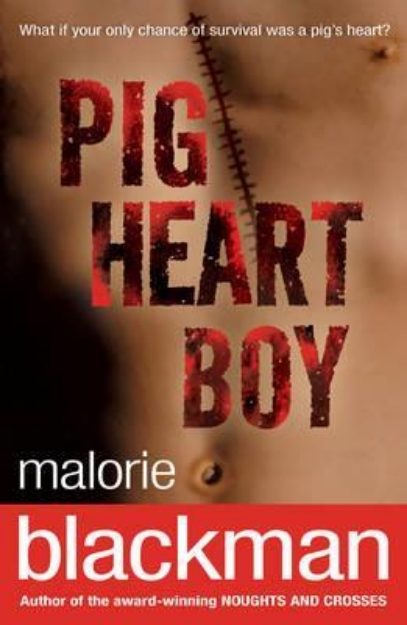 Picture of Pig Heart Boy